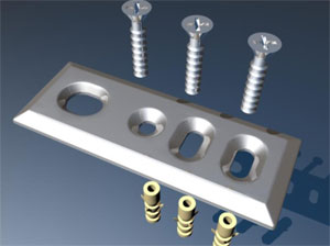 3009.00 ЗАПОРНАЯ ПЛАНКА ШПИНГАЛЕТА